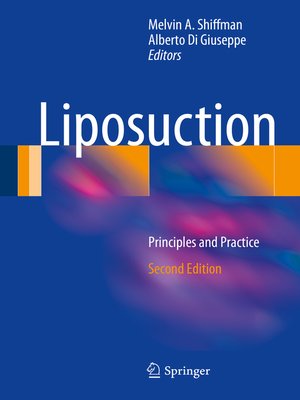 cover image of Liposuction